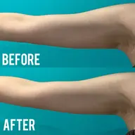 1度で実感‼️リンパ流し！最新マシン部分痩身モデル