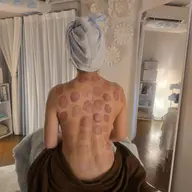 黄土漢方蒸し➕カッピングorスライドカッピングコース(背中) 計70分