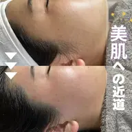 【学割🩵U24】フルフェイシャルワックス♪