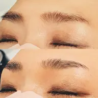 ハリウッドブロウリフト