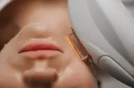 レディース顔脱毛