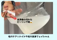 【ずっと同価格】ハイドラ毛穴洗浄✨　毛穴つまり/黒ずみを徹底ケア！　¥3000