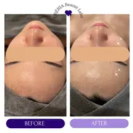 【ミニモ限定】men'sも🆗	「乾燥・ごわつきに💡やさしく効くソフトピーリング　60分