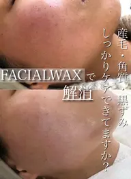 【フェイシャルwax】SNSで話題のハイドロジェリーマスク付き🧡