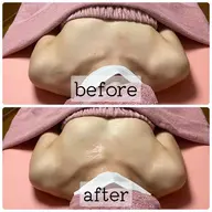 【5月限定】初回ミラクルバストプレミアム