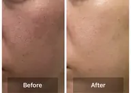 サクッと30分💆‍♀️ “30分でつるん肌”ハーブケア