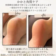 🦶かかと角質ケア