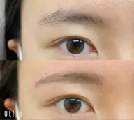 ハリウッドブロウリフト