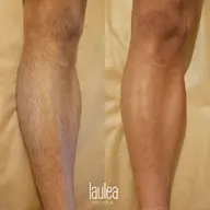 人気メニュー♪【脱毛】脚全体(太股～指先)