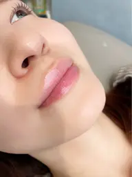 お手軽脱毛ワンパーツ！ミニモ特別価格！