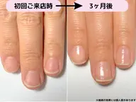 自爪育成《最強のネイルケア3ヶ月コース》育成ケア8回分/育成専用ホームケアセット込