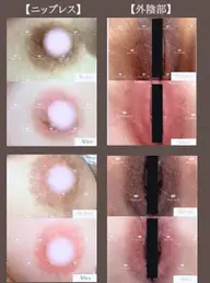 ローマピンク　唇　モニター様募集