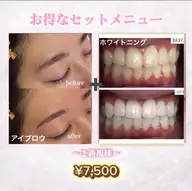 【🪞時短同時垢抜け 眉×歯set】一石二鳥の最強セット🕊️