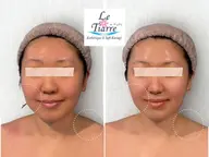 【小顔】彫刻美容小顔コルギ+上半身コルギ90分