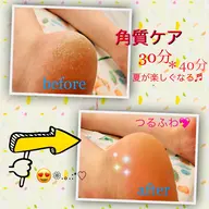 🦶🦶✨💖足裏角質ケア40分フットネイルも似合う美脚💕つるぴかな足裏で気分も上がる♬美容と健康の為のフットケアです