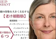 【目元の疲労感に】REDショットで目の下のクマ・たるみ・脂肪に徹底アプローチ
