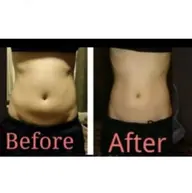 コルギ(顔、デコルテ、肩甲骨)×お腹ハイパーナイフ×石膏パック 施術時間95分