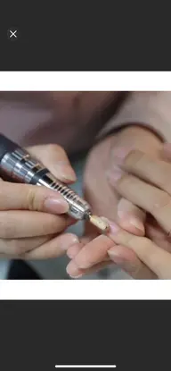 自爪オフのみ
