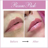 【韓国最先端ローマピンク】RomaPinkリップ◆                    カウンセリング