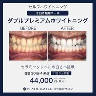 【ダブルプレミアムホワイトニング合計160分4来店分】白い歯を目指したい方へ