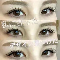 バインドロック300本(100束)