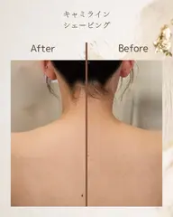 【顔/背中】顔&背中上段シェービング