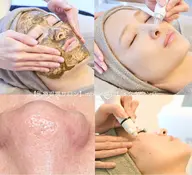 毛穴洗浄＋ハーブピーリング