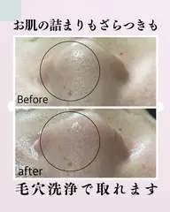 ニキビケア/くすみ/毛穴詰まり/いちご鼻に◎ 毛穴洗浄
