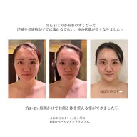 ミニモ限定価格☁️人気No.1 ♡オーダーメイドフェイシャル🌿お肌も癒しも叶える贅沢コース 70min~徹底肌・体改善