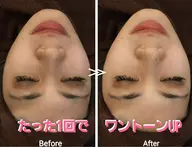 👑ミニモ限定特別メニュー👑✨毛穴洗浄スペシャル&脱毛カウンセリング✨❤️ 最新美容体験❣️満足度98%👑