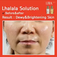 最新✨韓国🇰🇷で大人気💆♀️ララピール🖌️💕