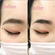 🫧美眉ワックス脱毛 🫧(男性も大歓迎✨️)今月限定価格クーポン🔥🔥