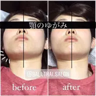 minimo限定❣️顎+首の歪み❣️あごのお悩み改善💆🏻♀️顎関節矯正体験❤️あごを小さく小顔に【小顔矯正】