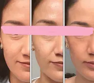 小顔美人リフトアップコース 50分 （希望者はメイクまで可能）