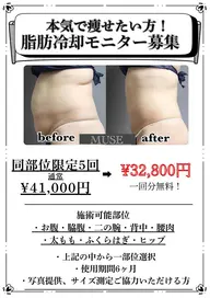 ミニモ限定 本気で痩せたい方限定🔥【脂肪痩身モニター様】同部位5回　通常¥41,000⇒¥32,800
