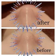 毛穴レス肌✨️毛穴洗浄ハイドロフェイシャル🫧 ͛.* ◆モデル練習価格◆