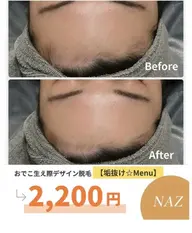 【新生活応援✨垢抜けメニュー】おでこ美形デザイン脱毛