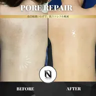 【🫧背中ニキビ×毛穴詰まりケア】PORE REPAIR｜自分では届かない背中に透明感を〈都度払いOK〉