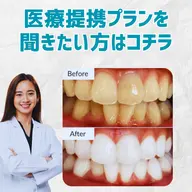プランを聞きたい方【プランお申込で医療提携ホワイトニング初回当日無料】