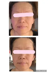 ❇︎しわ、たるみ改善コース 50分 （希望者はメイクまで可能）