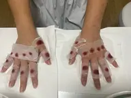 透明美白プレミアムコース