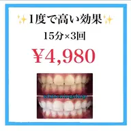 セルフホワイトニング 15分×3回