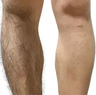 メンズ🚹脚or腕オールWAX