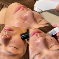 世代を問わない人気メニュー・肌荒れ改善フェイシャル