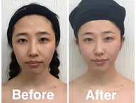 コルギモニター5回券(初回のみCRあり)みっちり50分🎶お顔もお身体もケア♡