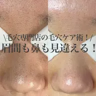 毛穴美人コース(80分)