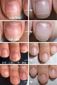 自宅ケア用ネイルオイル付き🌿深爪ケア・自爪育成✨クリアジェル💅🏻ツヤ仕上げor自爪風仕上げが選べます😊✨