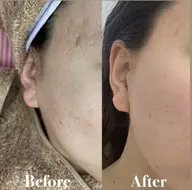 マリムーブフェイシャルwax（3日分のホームケア付）