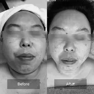 42%off❣️ミニモ限定❣️​〜​均整顔骨・修筋バランス​〜​⭐️6回分モニター募集⭐️