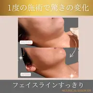 5月限定🌼たるみケアに月一の高周波✨美容クリニックでも主流の高周波マシンをエステサロンでご体験！